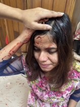 ঢাকায় বিএনপি নেতার বিরুদ্ধে হামলা, হত্যার হুমকি ও তরুণীকে গুরুতর আহত করার অভিযোগ ঢাকায় বিএনপি নেতার বিরুদ্ধে হামলা, হত্যার হুমকি ও তরুণীকে গুরুতর আহত করার অভিযোগ
